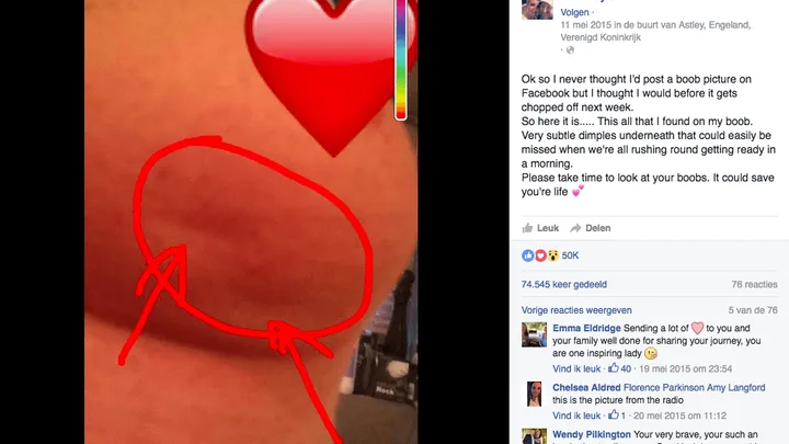 Deze vrouw deelt een onbekend symptoom van borstkanker, iedereen moet dit lezen! Delen svp!