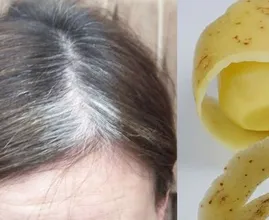 Du bekommst graue Haare? Dann solltest du das hier mit Kartoffelscheiben machen!