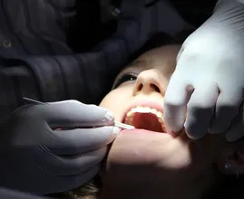 Sensitive teeth can be caused by these 7 things