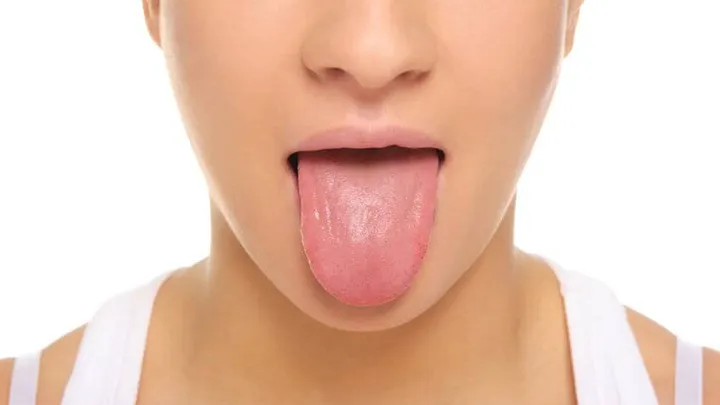 De conditie van je tong zegt heel wat over je gezondheid. Ontdek hoe jouw gezondheid is!