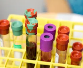 Dit is waarom het coronavirus minder dodelijk is voor vrouwen dan voor mannen