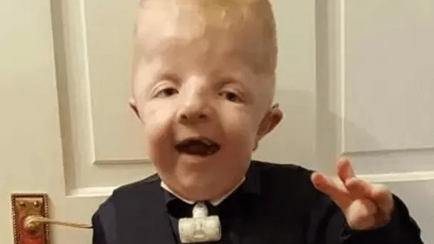 Foto van gehandicapte zoon misbruikt voor likes op Facebook: "Het is gewoon misselijkmakend"
