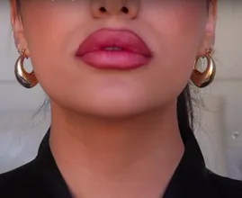 Teenagers try this bizarre trend for fuller lips