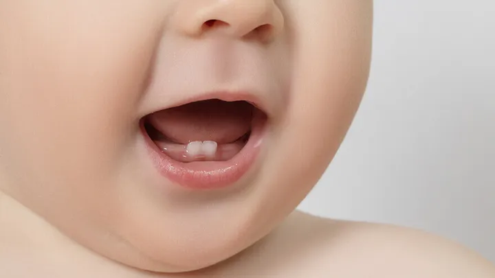 Você pode se surpreender, mas é uma boa ideia guardar os dentes de leite das crianças. Eles podem salvar uma vida!