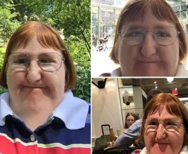 American blogger ‘who is too ugly’ to post photos hits back and receives dozens of statements of support