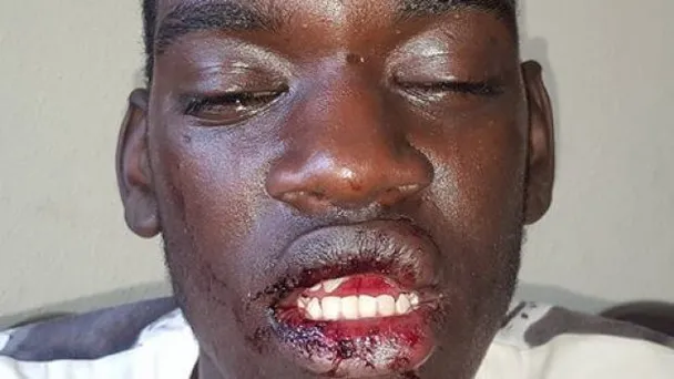 Jongen wordt slachtoffer van racisme; deel mee svp om de dader te vinden!