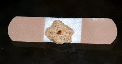 She puts a piece of bread on her child's plaster for a trick we didn't know yet!