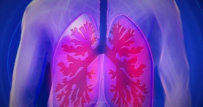 Everyone should know about this subtle symptom of lung cancer