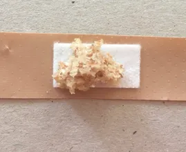 Das ist der geniale Grund warum du ein Stück Brot auf ein Pflaster kleben solltest!