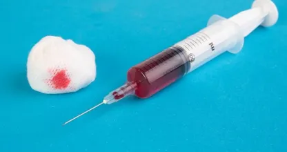 Sepsis: 3500 mensen overlijden er jaarlijks aan. Zo herken je het