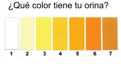 Esto dice el color de tu orina sobre tu salud