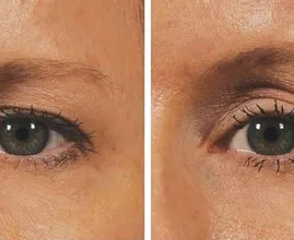 Leidest du unter hängenden Augenlidern? Dann schau dir DAS hier einmal an! Natürliches Lifting mit.... ?
