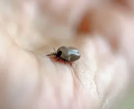 This is how you remove ticks safely!