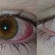 DIT 'onschuldige' speelgoed leidde tot blindheid bij haar zoon... Ze waarschuwt nu alle ouders!