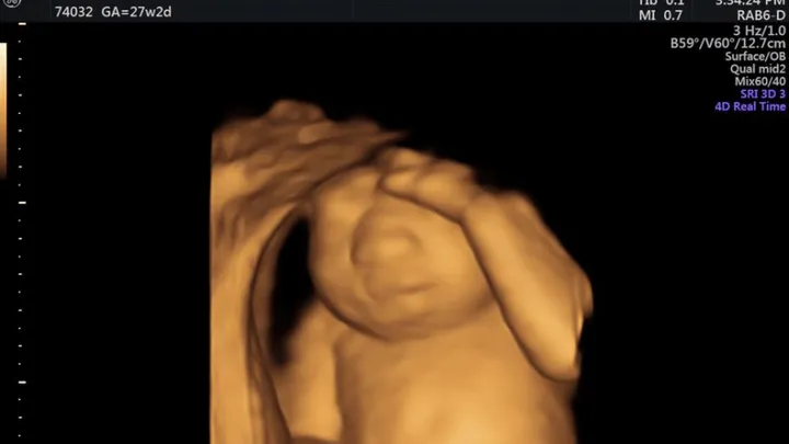 BIZAR: koppel laat niet levensvatbare baby tóch ter wereld komen voor orgaandonatie..