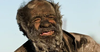 Ewww! This Man Hasn’t Taken A Bath In 65 Years