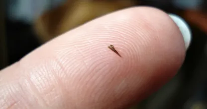 Splitter im Finger? So wirst du ihn wirklich mühelos los!