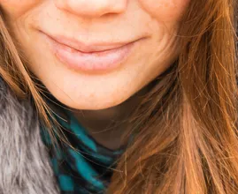 Witte velletjes op je lippen? Dan ben je misschien allergisch voor dít alledaags product