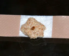 She puts a piece of bread on her child's plaster for a trick we didn't know yet!