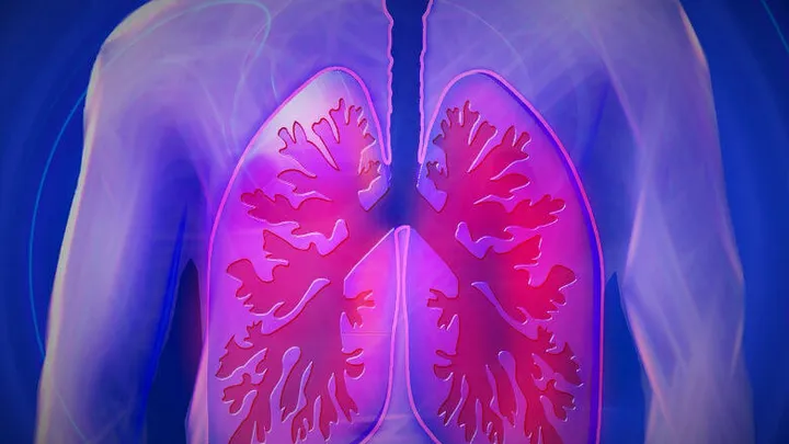 5 signalen die op COPD wijzen: dit zijn de symptomen van beschadigde longen