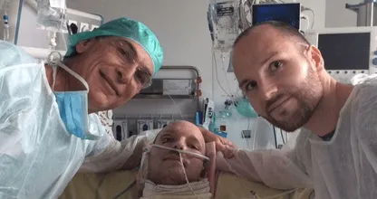 Man doneert 50 procent van zijn huid aan tweelingbroer: 'Hij werd levend gevild'