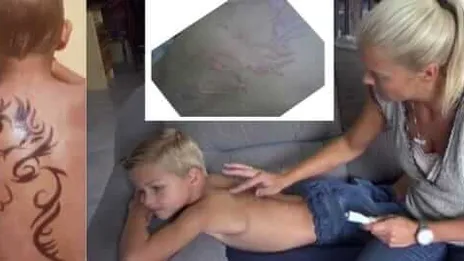 Oppassen geblazen! 7-jarige Belgische jongen verminkt na 'onschuldige' vakantie-tatoeage.