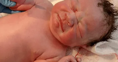 Dit lijkt een 'gewone' foto van een pasgeboren baby, maar als je nog een keer kijkt... Zie jij het?!