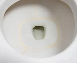 This is why bleach won't remove the brown ring in your toilet—and what experts recommend