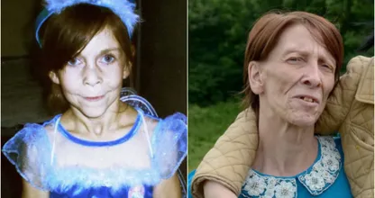 BIZAR: deze twintigjarige vrouw zag eruit als bejaarde vrouw maar moet je haar nu eens zien!