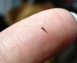 Splitter im Finger? So wirst du ihn wirklich mühelos los!