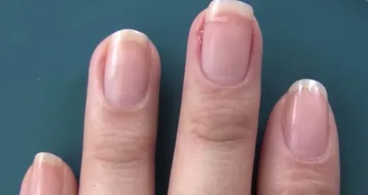 Ouch, a torn nail! With this weird trick you could repair it in no time