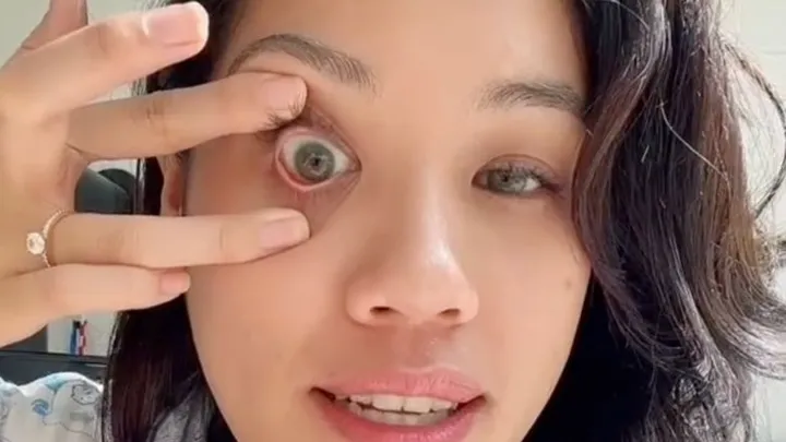 This well-known TikTokker has a golden tip for removing your lenses super fast