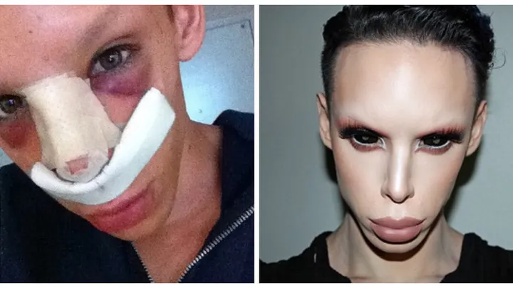 Vinny (22) wil zich laten ombouwen tot genderneutrale alien:  ,,Ik zou niet weten waarom ik niet níéts zou kunnen hebben, daar beneden!'