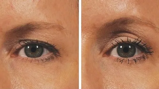 ¿Sufres de párpados caídos? ¡Entonces echa un vistazo a ESTA maravilla! ¿Levantamiento natural con...?
