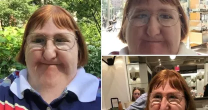 American blogger ‘who is too ugly’ to post photos hits back and receives dozens of statements of support