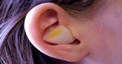 Das verblüffende passiert wenn du den Kern von Zwiebeln nachts auf dein Ohr klemmst.