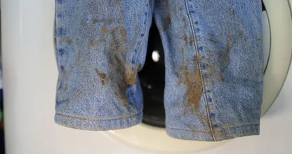 5 easy tips to get rust stains out of your clothes and shoes