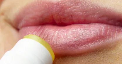 Du denkst Lippenbalsam schützt aber eigentlich macht es alles nur schlimmer!