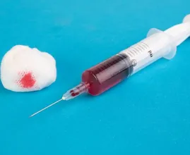 Sepsis: 3500 mensen overlijden er jaarlijks aan. Zo herken je het