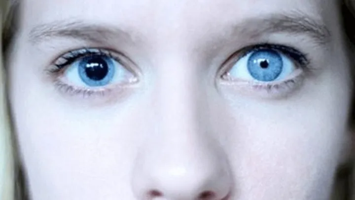 20 People With Unique Genetic Traits That Are Hard to Forget