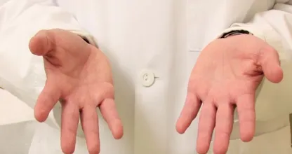 Voorkom zweethanden door altijd dit product bij de hand te hebben