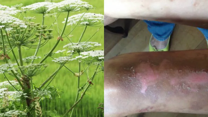WAARSCHUWING: heb je kinderen? Zorg dan dat dit niet bij ze gebeurt en waarschuw ze voor deze plant!